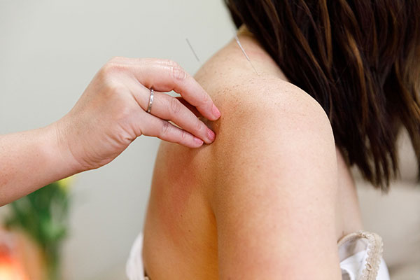 Read more about the article Pain and Acupuncture