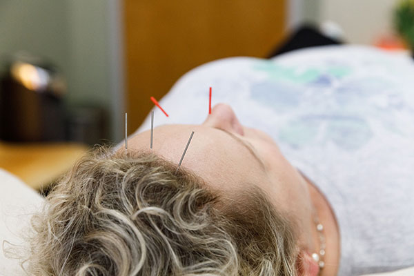 Read more about the article Acid Reflux & Acupuncture